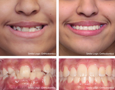 Crowding